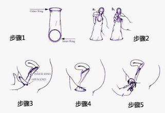 垃圾桶里的這半盒避孕套，可能是一次誤會——或者是危機