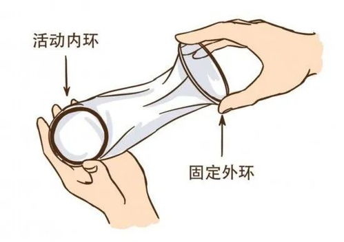 女用避孕套使用指南 安全套正確操作全過程詳解